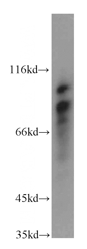 human heart tissue were subjected to SDS PAGE followed by western blot with Catalog No:112974(MYLK3 antibody) at dilution of 1:500