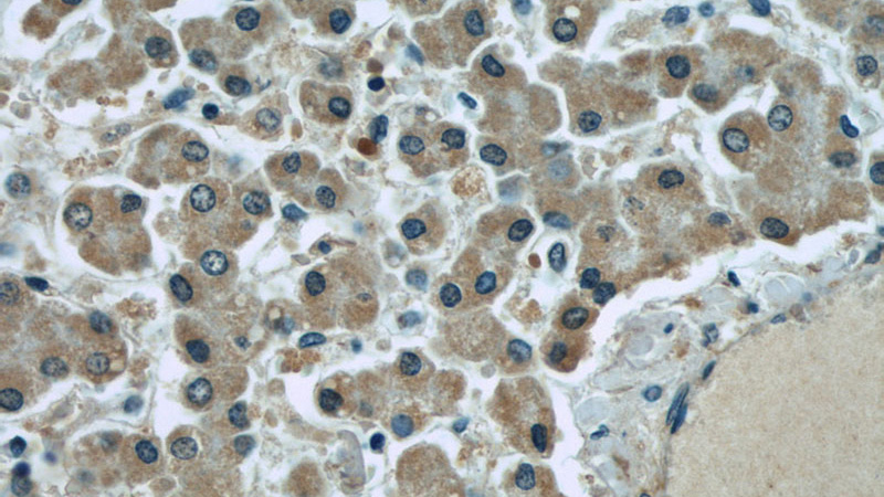 Immunohistochemical of paraffin-embedded human liver using Catalog No:107199(F12 antibody) at dilution of 1:50 (under 40x lens)
