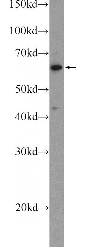 A431 cells were subjected to SDS PAGE followed by western blot with Catalog No:115952(KIAA0748 Antibody) at dilution of 1:1000