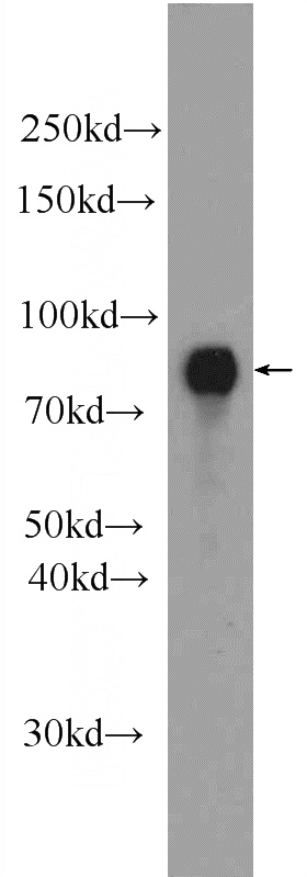 mouse brain tissue were subjected to SDS PAGE followed by western blot with Catalog No:114220(ProSAPiP1 Antibody) at dilution of 1:600