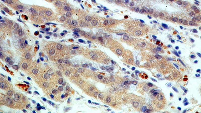 Immunohistochemical of paraffin-embedded human stomach using Catalog No:116687(USP49 antibody) at dilution of 1:50 (under 40x lens)