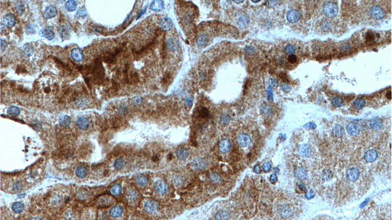 Immunohistochemistry of paraffin-embedded human kidney tissue slide using Catalog No:113308(NOTCH1 Antibody) at dilution of 1:200 (under 40x lens).