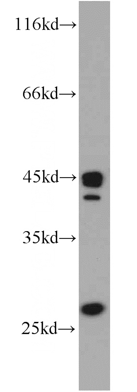 HEK-293 cells were subjected to SDS PAGE followed by western blot with Catalog No:115013(SCO2 antibody) at dilution of 1:500