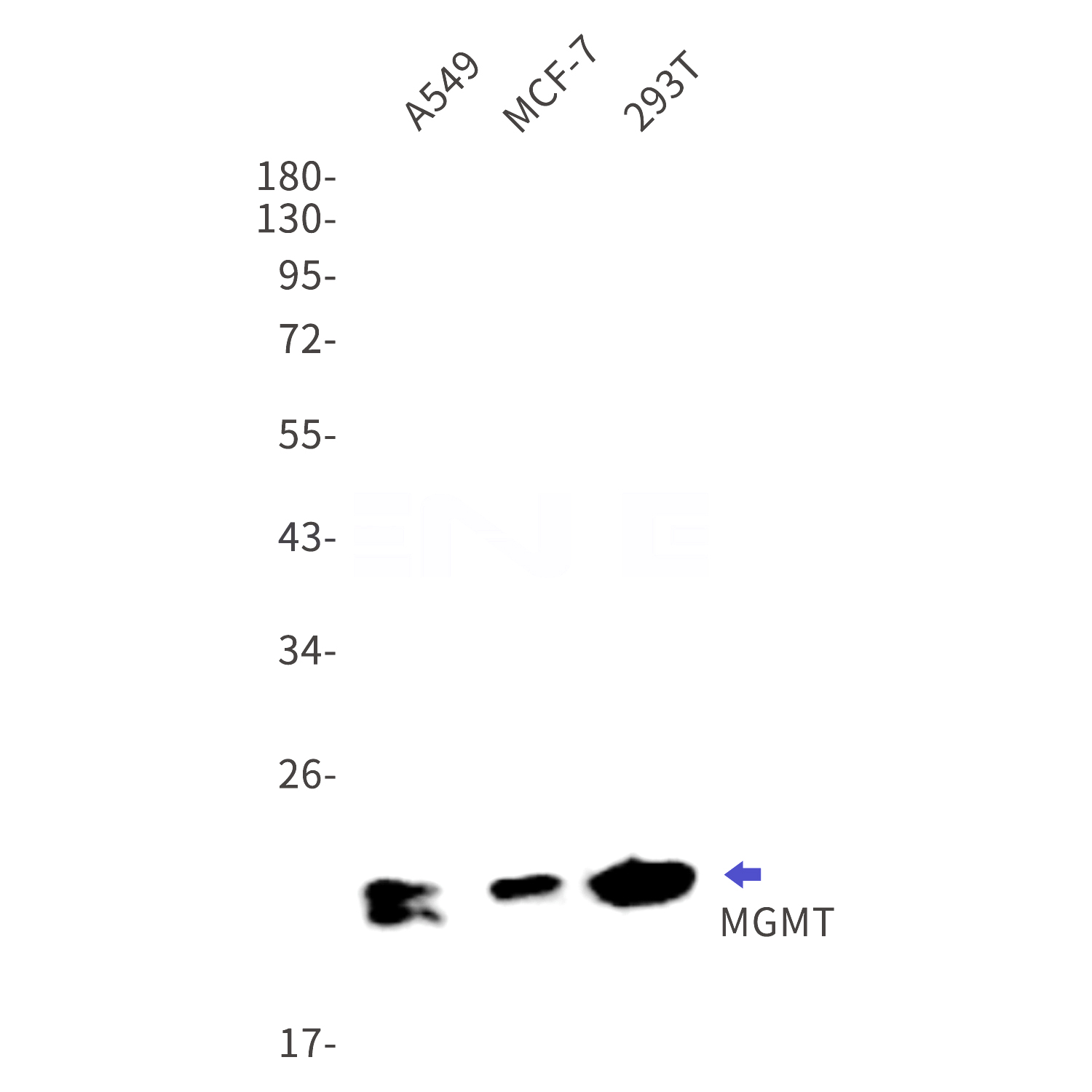 Western blot detection of MGMT in A549,MCF-7,293T cell lysates using MGMT Rabbit mAb(1:1000 diluted).Predicted band size:22kDa.Observed band size:22kDa.