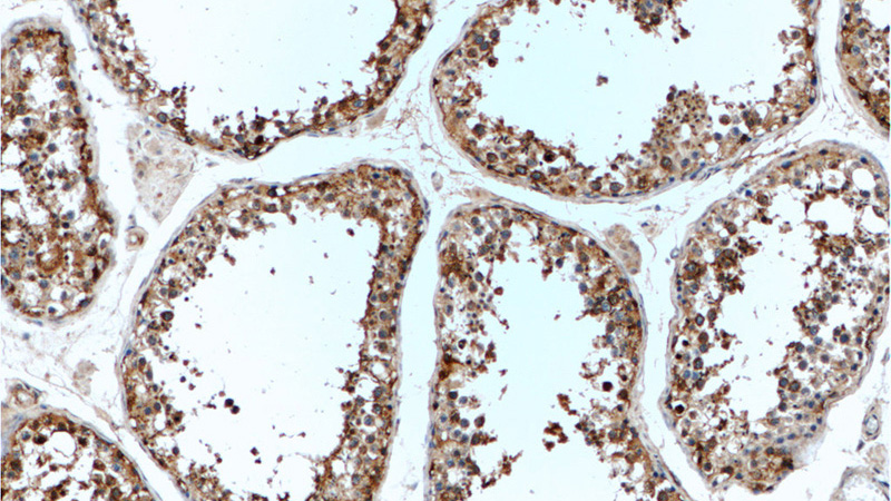 Immunohistochemistry of paraffin-embedded human testis tissue slide using Catalog No:111850(INSL3 Antibody) at dilution of 1:50 (under 10x lens)
