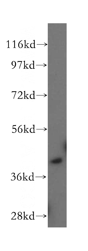 Jurkat cells were subjected to SDS PAGE followed by western blot with Catalog No:109075(CCR2a-specific antibody) at dilution of 1:200