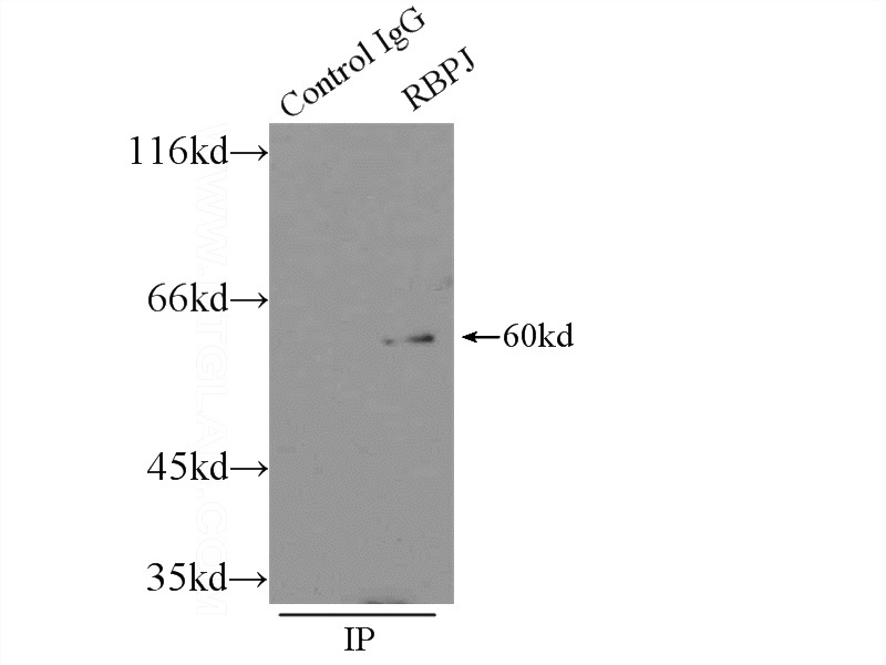 IP Result of anti-RBPJ (IP:Catalog No:114565, 3ug; Detection:Catalog No:114565 1:1000) with HEK-293 cells lysate 4500ug.
