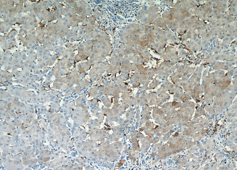 Immunohistochemical of paraffin-embedded human hepatocirrhosis using Catalog No:110429(F4-80 antibody) at dilution of 1:50 (under 10x lens)