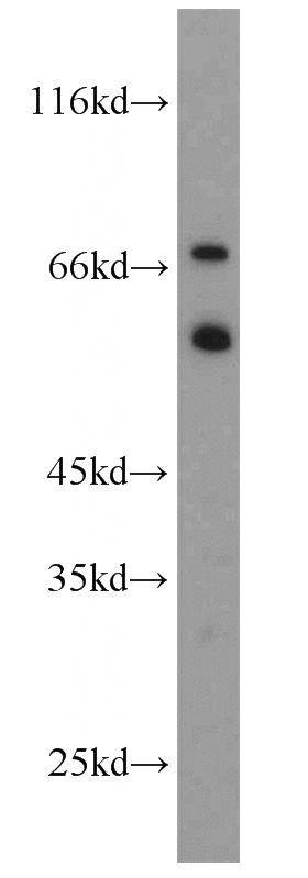 mouse brain tissue were subjected to SDS PAGE followed by western blot with Catalog No:114744(MGRN1 antibody) at dilution of 1:500