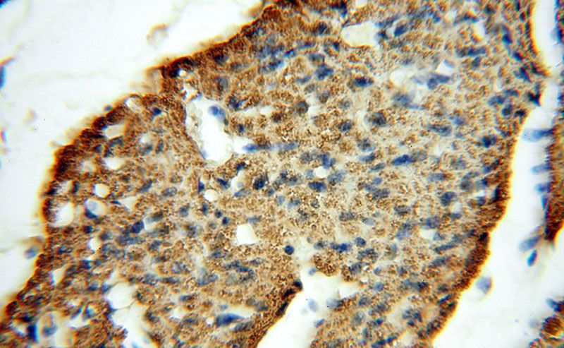 Immunohistochemical of paraffin-embedded human heart using Catalog No:116775(VPS24 antibody) at dilution of 1:50 (under 40x lens)