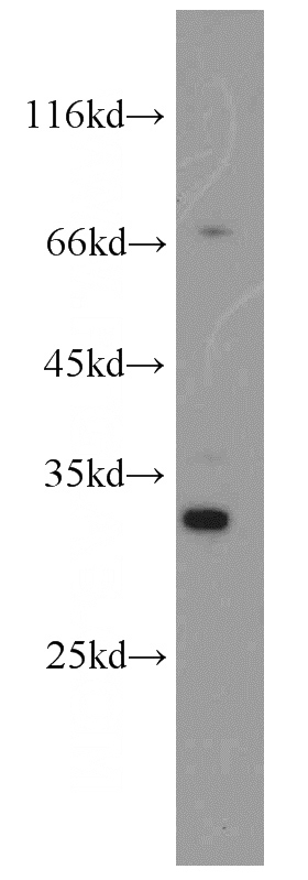 HeLa cells were subjected to SDS PAGE followed by western blot with Catalog No:110644(FGL1 antibody) at dilution of 1:500