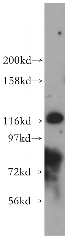 Jurkat cells were subjected to SDS PAGE followed by western blot with Catalog No:116573(UNC13D antibody) at dilution of 1:300