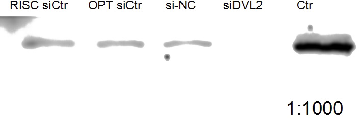 WB result of DVL2 antibody (Catalog No:110125, 1:1000) with siDVL2 transfected cells.