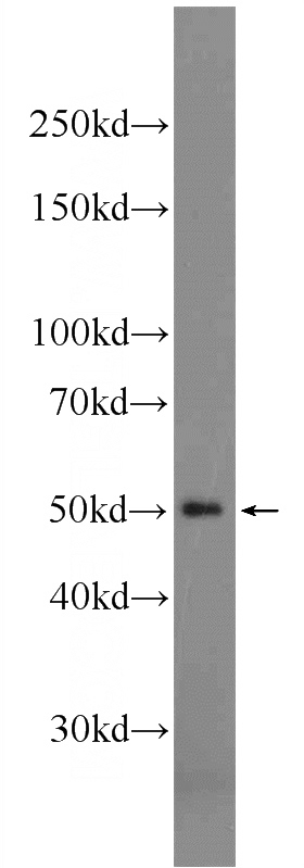 rat testis tissue were subjected to SDS PAGE followed by western blot with Catalog No:115116(SEPT14 Antibody) at dilution of 1:1000