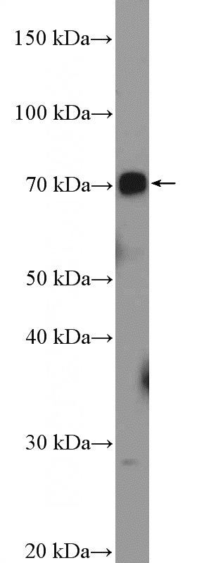 mouse kidney tissue were subjected to SDS PAGE followed by western blot with Catalog No:116656(UBOX5 Antibody) at dilution of 1:600