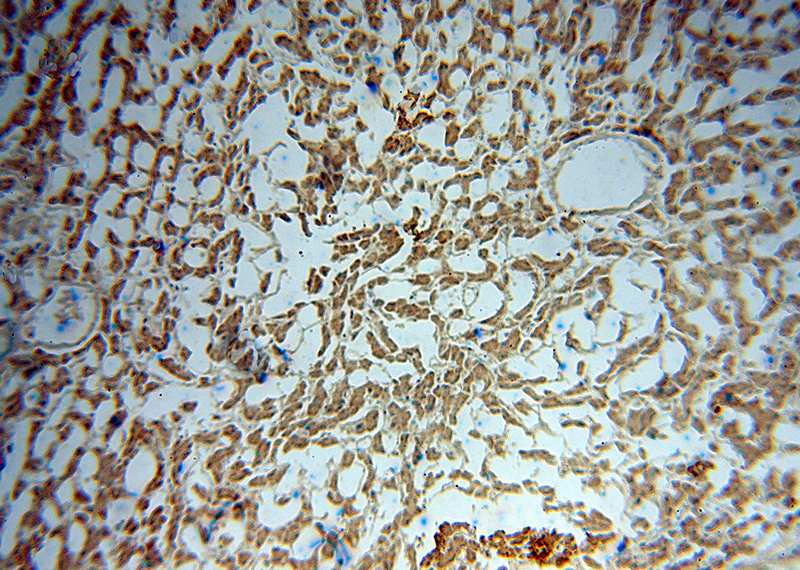 Immunohistochemical of paraffin-embedded human liver using Catalog No:117112(BDH1 antibody) at dilution of 1:50 (under 10x lens)