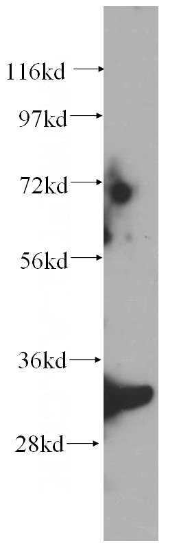 mouse liver tissue were subjected to SDS PAGE followed by western blot with Catalog No:114995(SCGN antibody) at dilution of 1:300