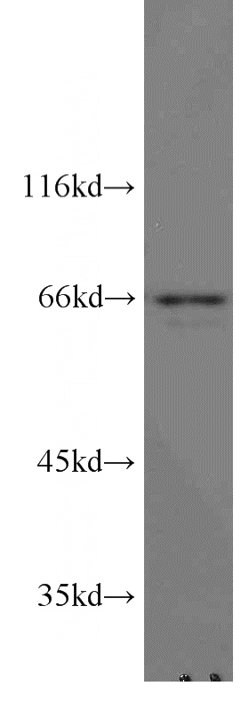 mouse brain tissue were subjected to SDS PAGE followed by western blot with Catalog No:115673(STAM2 antibody) at dilution of 1:1000