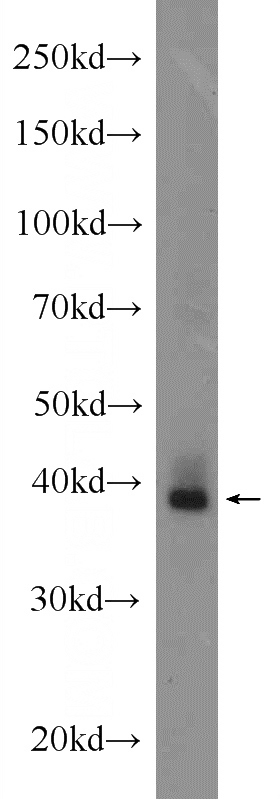 mouse eye tissue were subjected to SDS PAGE followed by western blot with Catalog No:107783(ADORA1 Antibody) at dilution of 1:600