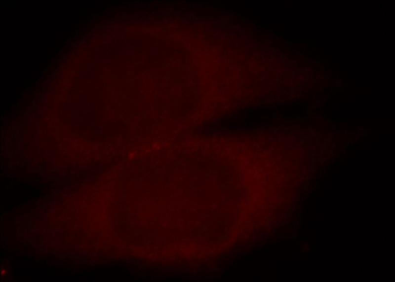 Immunofluorescent analysis of Hela cells, using CASR antibody Catalog No:108816 at 1:25 dilution and Rhodamine-labeled goat anti-rabbit IgG (red).