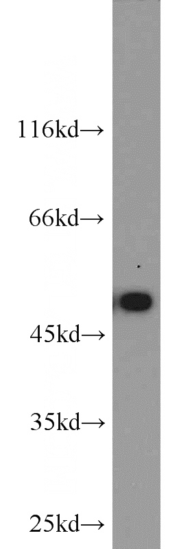HEK-293 cells were subjected to SDS PAGE followed by western blot with Catalog No:108915(CAMK2A-Specific antibody) at dilution of 1:1000