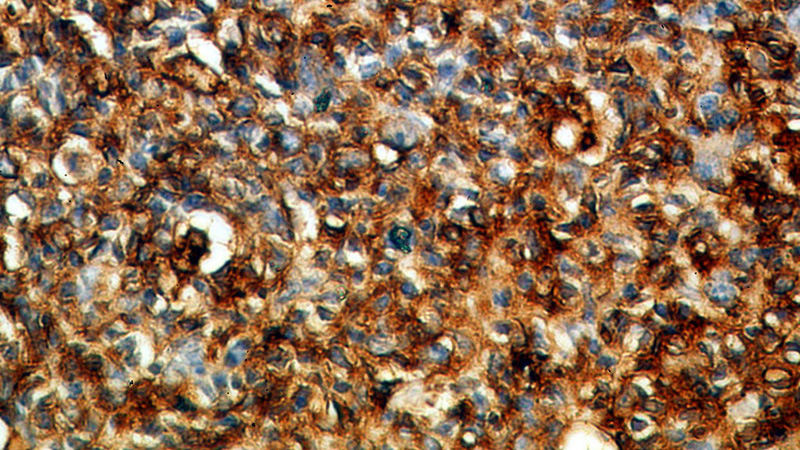 Immunohistochemical of paraffin-embedded human tonsil using Catalog No:111425(HLA-DRA antibody) at dilution of 1:50 (under 40x lens)