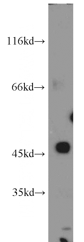 SH-SY5Y cells were subjected to SDS PAGE followed by western blot with Catalog No:116089(TMEFF2 antibody) at dilution of 1:300