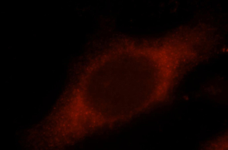 Immunofluorescent analysis of Hela cells, using PDCD6IP antibody Catalog No:113768 at 1:25 dilution and Rhodamine-labeled goat anti-rabbit IgG (red).