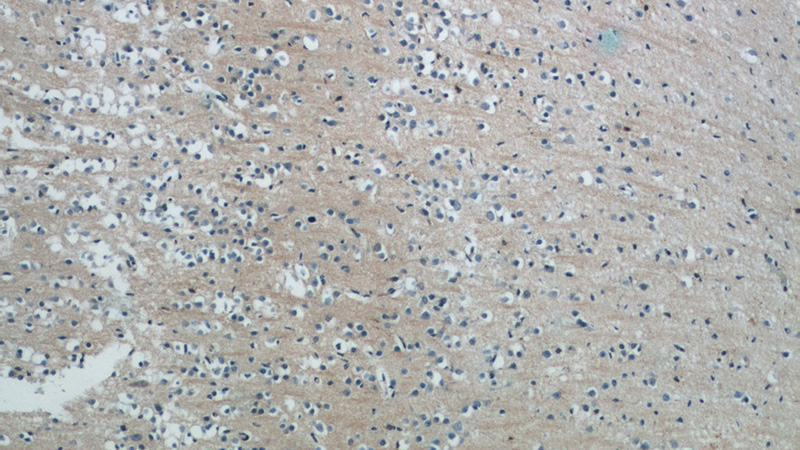 Immunohistochemistry of paraffin-embedded human brain tissue slide using Catalog No:112680(KIAA1804 Antibody) at dilution of 1:50 (under 10x lens)