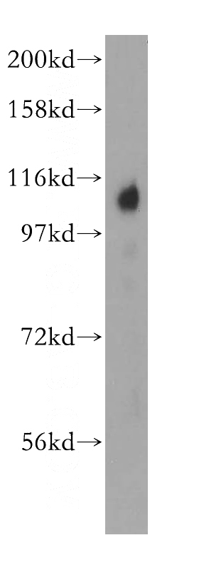 human liver tissue were subjected to SDS PAGE followed by western blot with Catalog No:116238(TRAK2 antibody) at dilution of 1:500