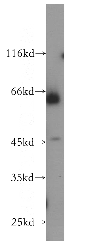 HL-60 cells were subjected to SDS PAGE followed by western blot with Catalog No:113883(PIAS4 antibody) at dilution of 1:600