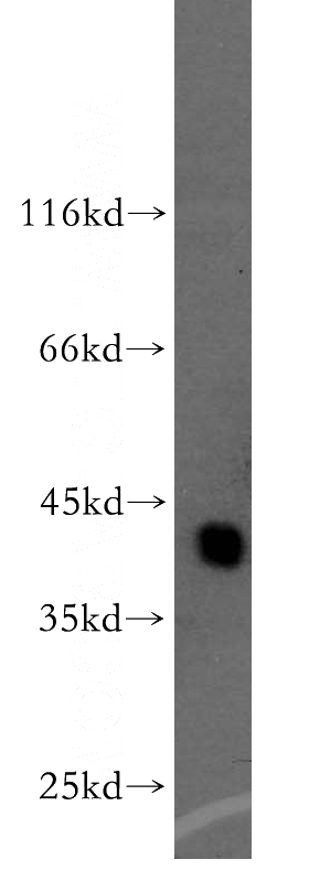 human kidney tissue were subjected to SDS PAGE followed by western blot with Catalog No:108382(BCAT1 antibody) at dilution of 1:300