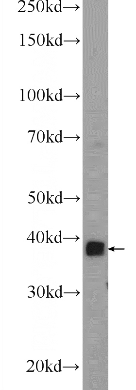 mouse skeletal muscle tissue were subjected to SDS PAGE followed by western blot with Catalog No:112508(MBNL3 Antibody) at dilution of 1:600