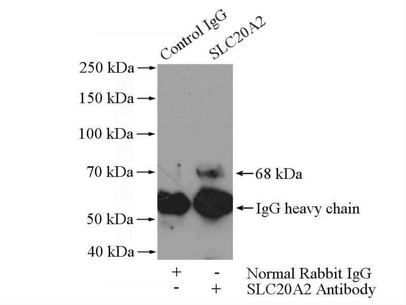 IP Result of anti-SLC20A2 (IP:Catalog No:115311, 4ug; Detection:Catalog No:115311 1:400) with COLO 320 cells lysate 2400ug.
