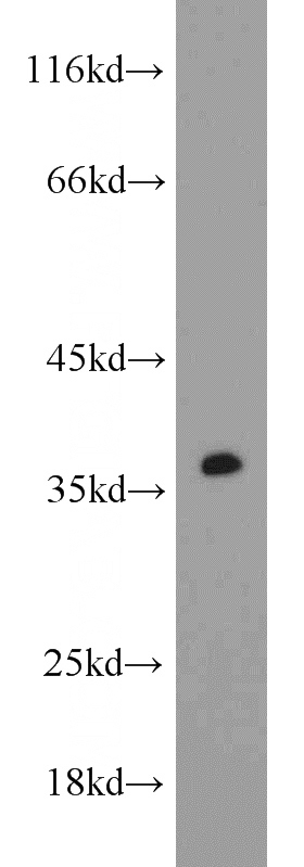 rat brain tissue were subjected to SDS PAGE followed by western blot with Catalog No:108926(CAMLG antibody) at dilution of 1:1000