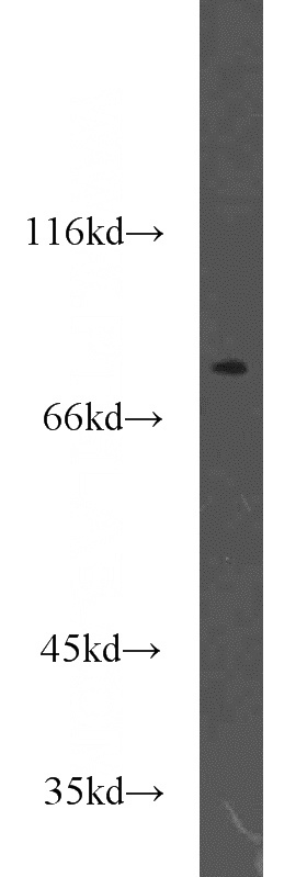 A431 cells were subjected to SDS PAGE followed by western blot with Catalog No:116109(TMEM181 antibody) at dilution of 1:300