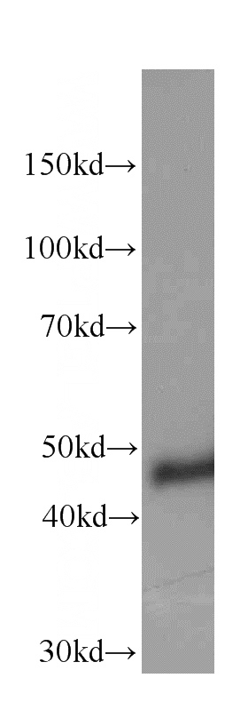 SH-SY5Y cells were subjected to SDS PAGE followed by western blot with Catalog No:107339(ENO2 Antibody) at dilution of 1:1000