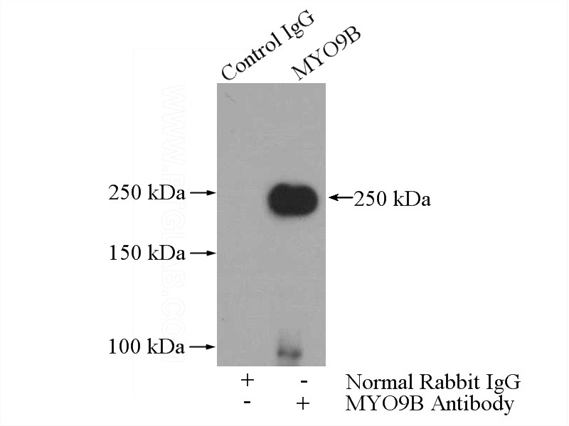 IP Result of anti-MYO9B (IP:Catalog No:112988, 5ug; Detection:Catalog No:112988 1:500) with HepG2 cells lysate 2800ug.