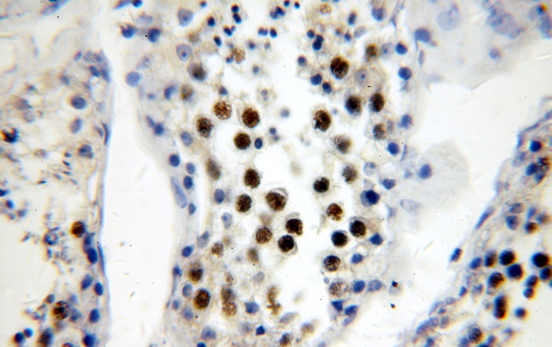 Immunohistochemical of paraffin-embedded human testis using Catalog No:114633(RFWD3 antibody) at dilution of 1:400 (under 40x lens)