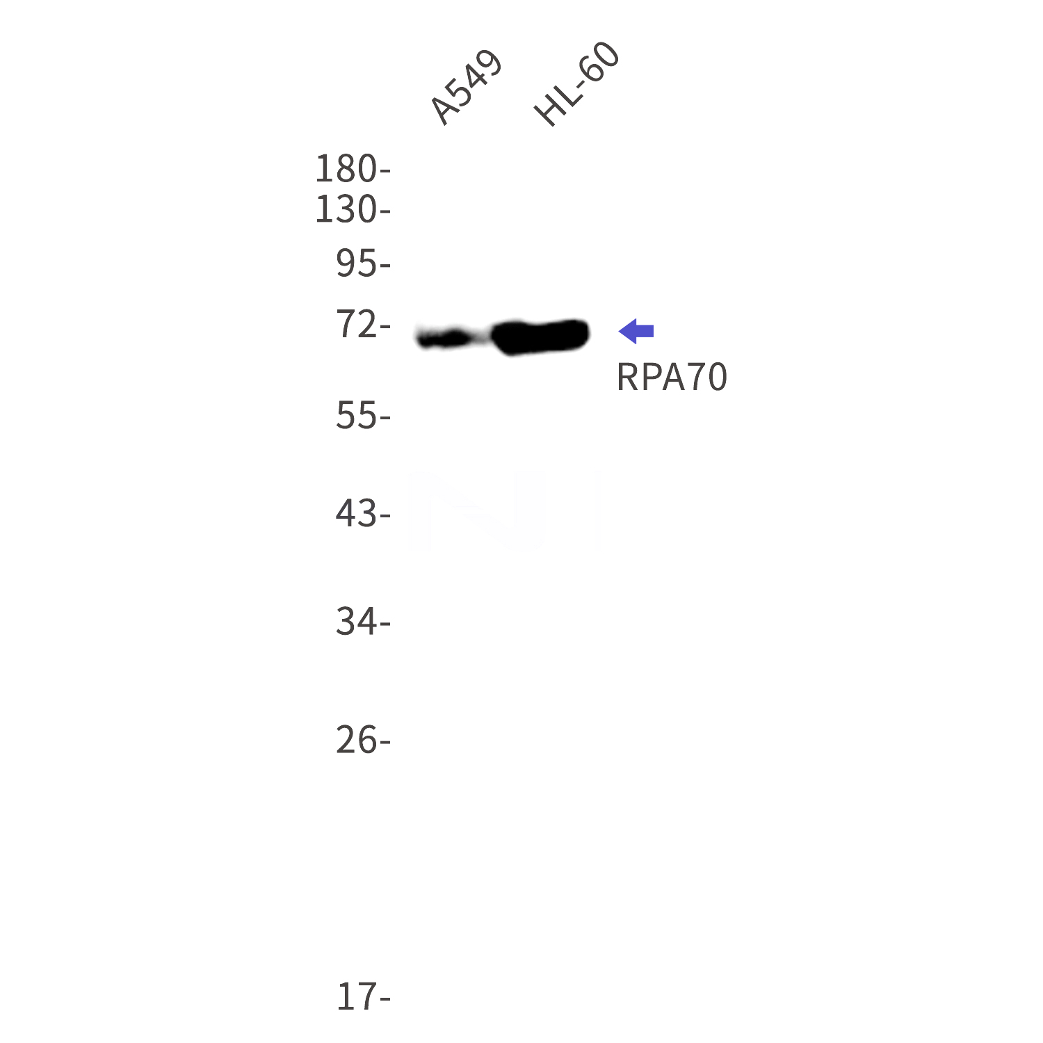 Western blot detection of RPA70 in A549,HL-60 cell lysates using RPA70 Rabbit mAb(1:1000 diluted).Predicted band size:68kDa.Observed band size:70kDa.