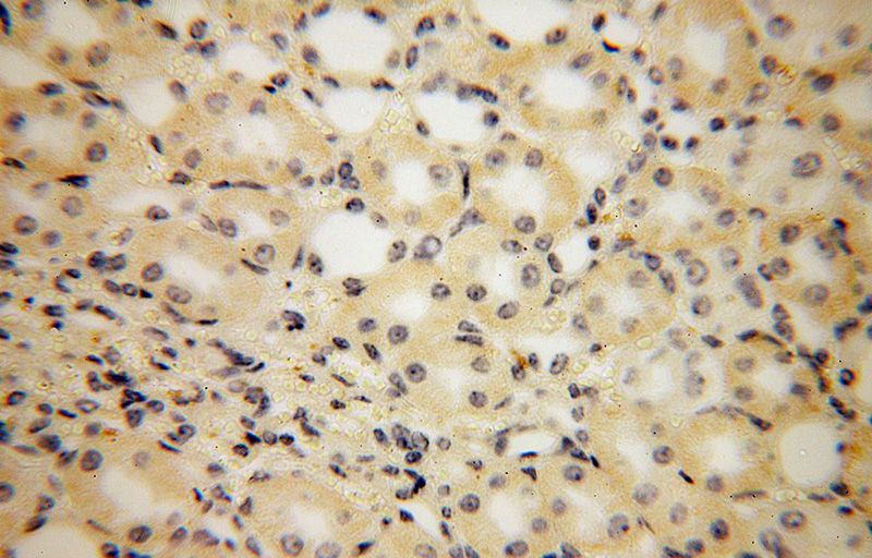 Immunohistochemical of paraffin-embedded human kidney using Catalog No:113835(PISD antibody) at dilution of 1:100 (under 40x lens)