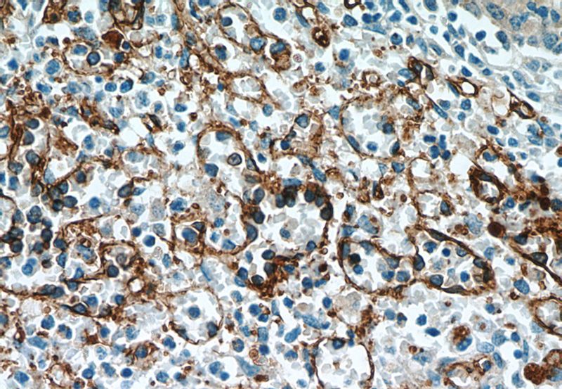 Immunohistochemical of paraffin-embedded human spleen using Catalog No:109031(CD36 antibody) at dilution of 1:50 (under 40x lens)