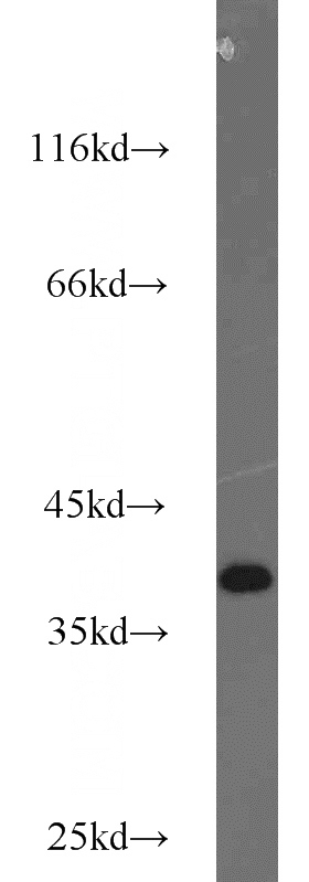 Jurkat cells were subjected to SDS PAGE followed by western blot with Catalog No:116930(ZC3HAV1L antibody) at dilution of 1:1000
