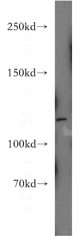 HeLa cells were subjected to SDS PAGE followed by western blot with Catalog No:113563(PALLD,palladin-Specific antibody) at dilution of 1:200