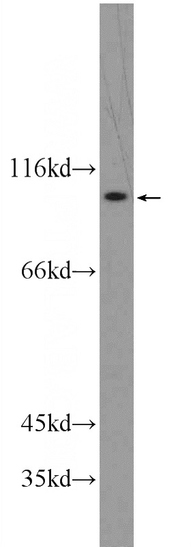 HEK-293 cells were subjected to SDS PAGE followed by western blot with Catalog No:108338(ATP12A Antibody) at dilution of 1:500