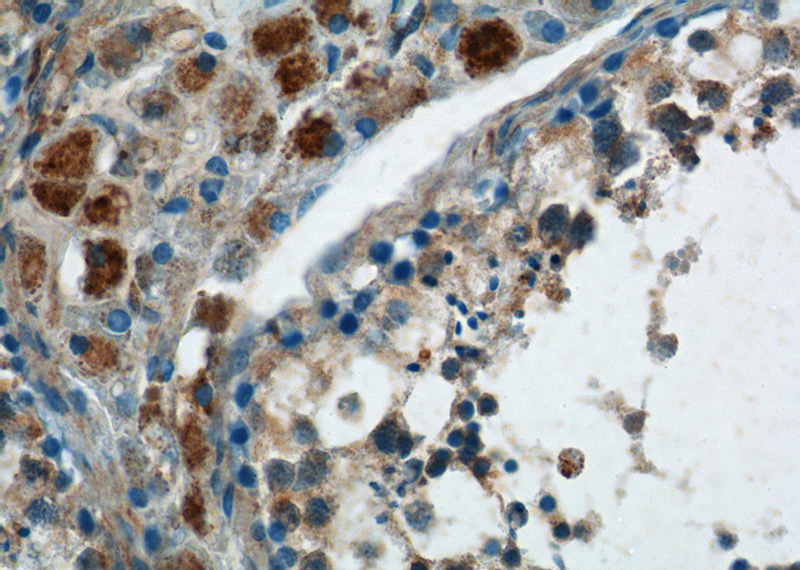 Immunohistochemistry of paraffin-embedded human testis tissue slide using Catalog No:115553(SPATA3 Antibody) at dilution of 1:50 (under 40x lens)