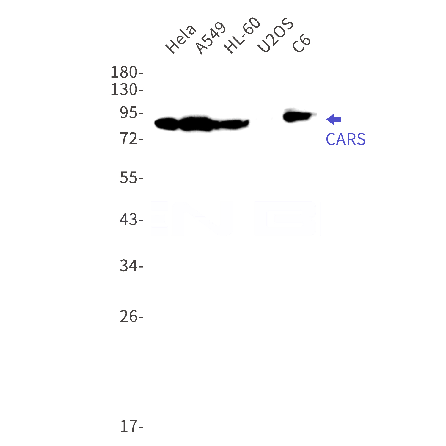 Western blot detection of CARS in Hela,A549,HL-60,U2OS,C6 cell lysates using CARS Rabbit mAb(1:1000 diluted).Predicted band size:86kDa.Observed band size:86kDa.