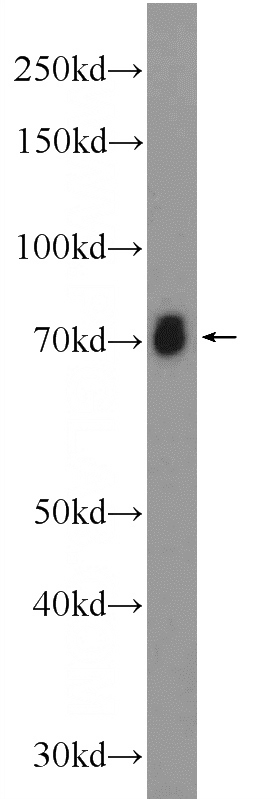 rat brain tissue were subjected to SDS PAGE followed by western blot with Catalog No:108229(ACCN1 Antibody) at dilution of 1:300