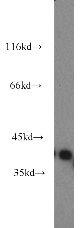 human brain tissue were subjected to SDS PAGE followed by western blot with Catalog No:109766(DCX antibody) at dilution of 1:600