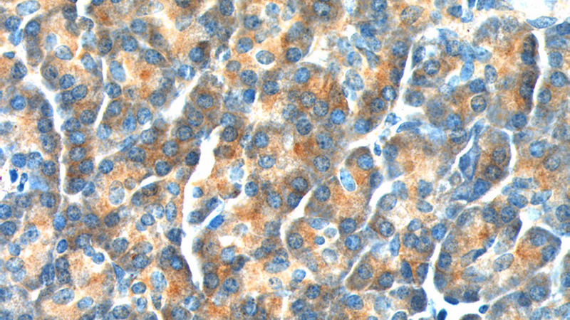 Immunohistochemistry of paraffin-embedded human pancreas tissue slide using Catalog No:116892(YRDC Antibody) at dilution of 1:200 (under 40x lens).